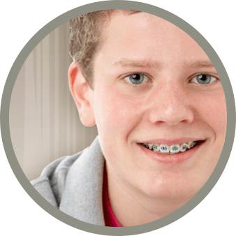 A teenage boy smiling with braces on in front of a tan and white backdrop.
